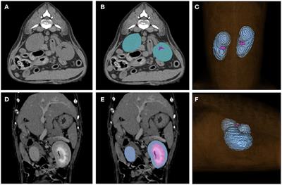 A deep learning model for CT-based kidney volume determination in dogs and normal reference definition
